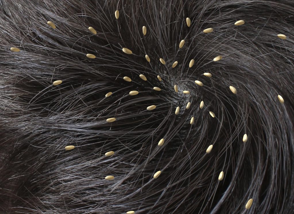 Black hair lice deals